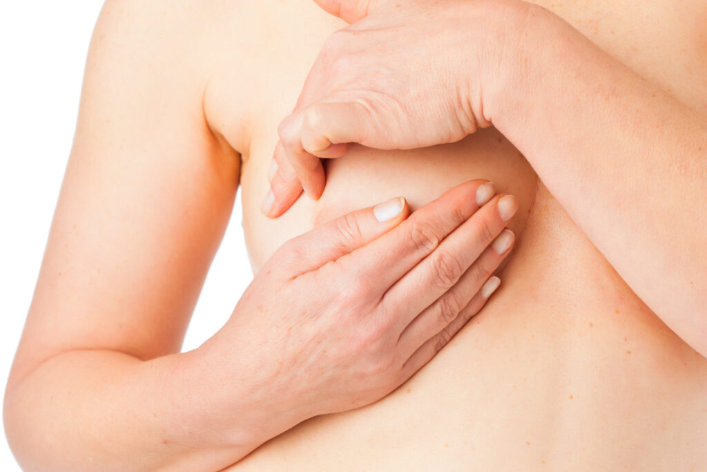 Quistes mamarios:  tipos de tratamiento