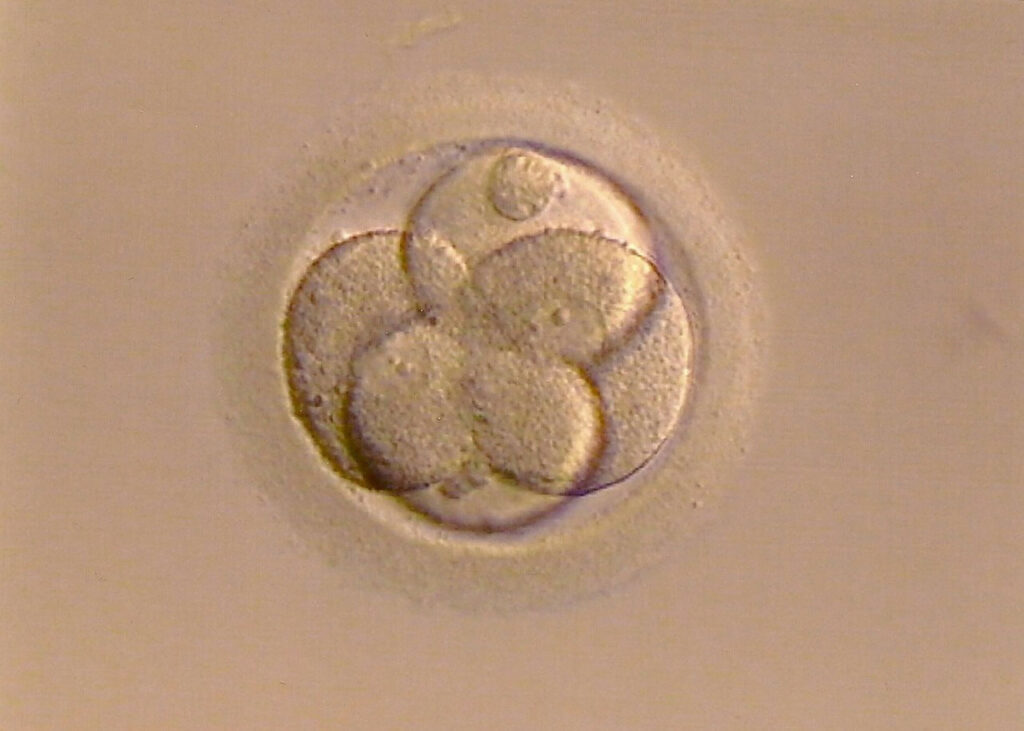 fecundación in vitro en granada de un óvulo